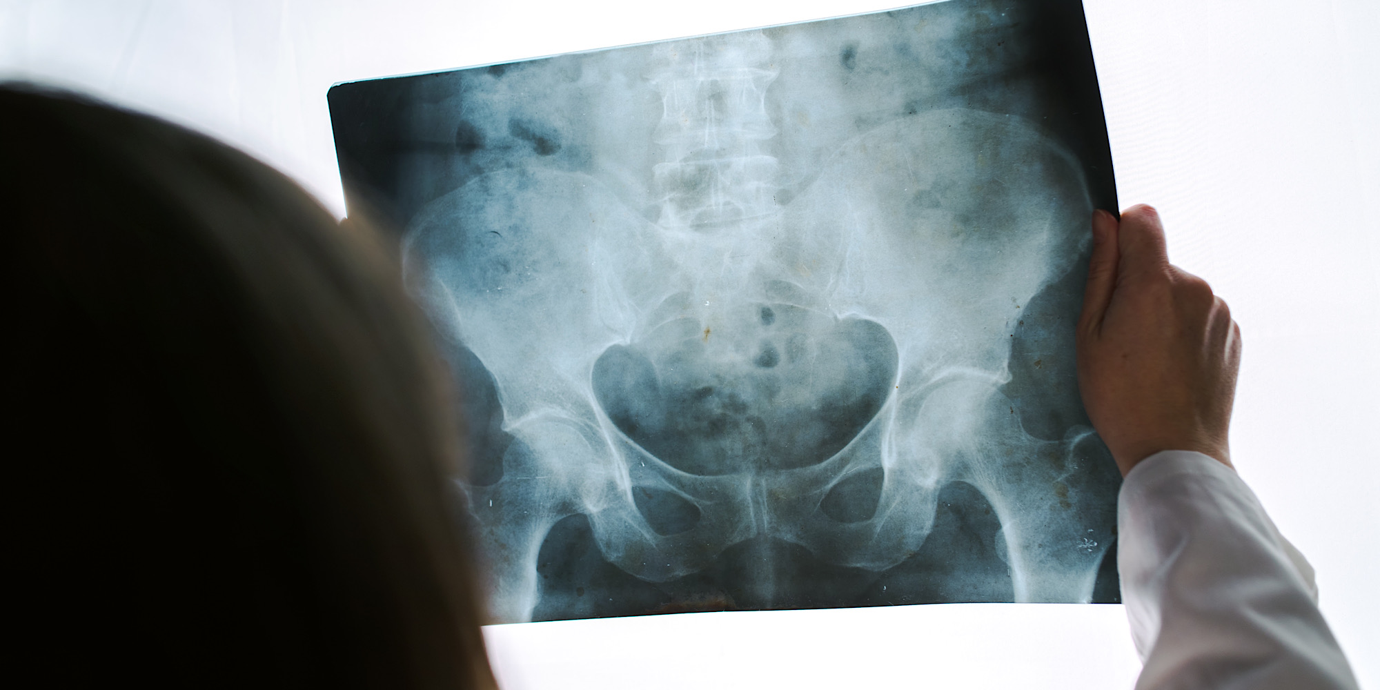 Female doctor examining pelvis x-ray in hospital office